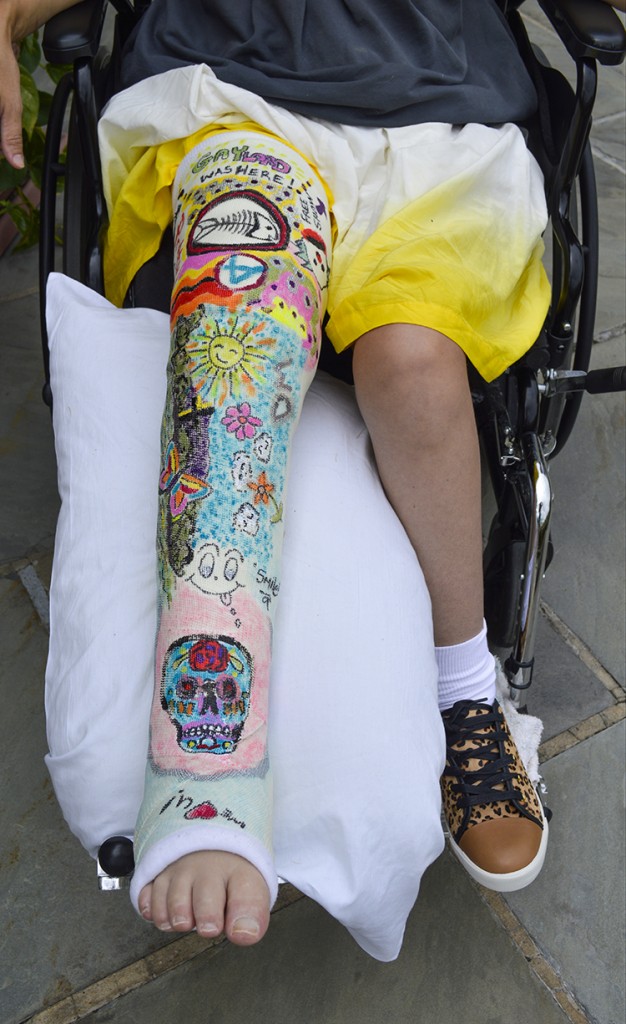 colorful creative female leg cast