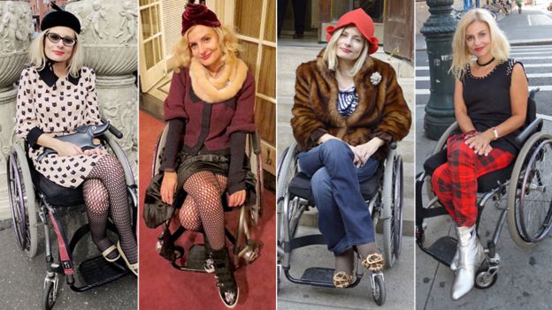 BBC News Too Pretty in a Wheelchair